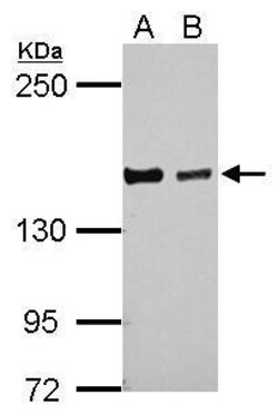 Invitrogen DZIP3 Polyclonal Antibody 100 &mu;L; Unconjugated:Antibodies,