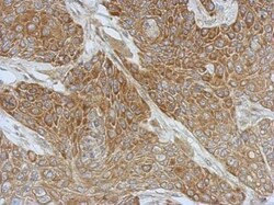 Invitrogen DZIP3 Polyclonal Antibody 100 &mu;L; Unconjugated:Antibodies,