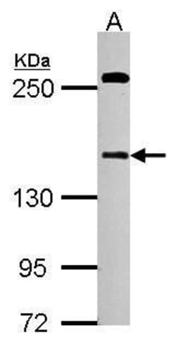 Invitrogen DZIP3 Polyclonal Antibody 100 &mu;L; Unconjugated:Antibodies,