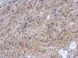 DZIP3 Polyclonal Antibody:Antibodies, Polyclonal