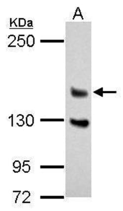 DZIP3 Polyclonal Antibody:Antibodies, Polyclonal