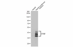 Invitrogen CTGF Polyclonal Antibody 100 &mu;L; Unconjugated:Antibodies,