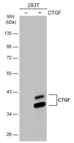 Invitrogen CTGF Polyclonal Antibody 100 &mu;L; Unconjugated:Antibodies,