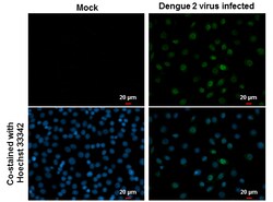 Invitrogen Dengue Virus Type 2 NS5 Polyclonal Antibody 100 &mu;L; Unconjugated:Antibodies,