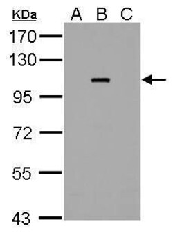 Invitrogen Dengue Virus Type 2 NS5 Polyclonal Antibody 100 &mu;L; Unconjugated:Antibodies,