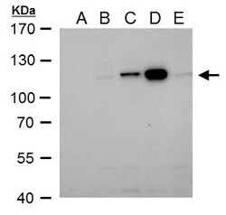 Invitrogen Dengue Virus Type 2 NS5 Polyclonal Antibody 100 &mu;L; Unconjugated:Antibodies,