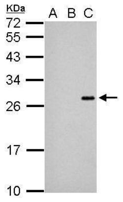 Invitrogen Japanese Encephalitis Virus NS4B Polyclonal Antibody 100 &mu;L | Buy Online | Invitrogen&trade; | Fisher Scientific