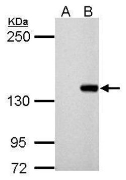 Invitrogen DNMT3B Polyclonal Antibody 100 &mu;L; Unconjugated:Antibodies,