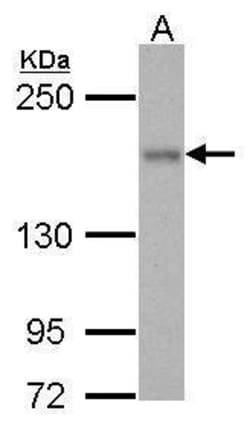 Invitrogen ROCK1 Polyclonal Antibody 100 &mu;L; Unconjugated:Antibodies,