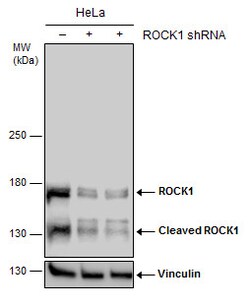 Invitrogen ROCK1 Polyclonal Antibody 100 &mu;L; Unconjugated:Antibodies,