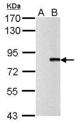 Invitrogen Influenza A PB2 Polyclonal Antibody 100 &mu;L; Unconjugated:Antibodies,