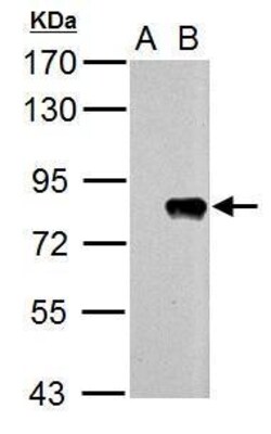 Invitrogen Influenza A PB2 Polyclonal Antibody 100 &mu;L; Unconjugated:Antibodies,