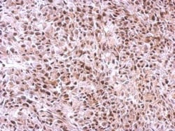 Invitrogen SLU7 Polyclonal Antibody 100 &mu;L; Unconjugated:Antibodies,