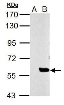 Invitrogen SLU7 Polyclonal Antibody 100 &mu;L; Unconjugated:Antibodies,