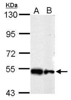 Invitrogen SHMT2 Polyclonal Antibody 100 &mu;L; Unconjugated:Antibodies,
