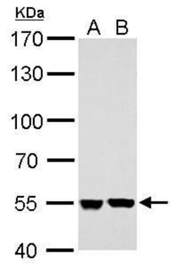 Invitrogen SHMT2 Polyclonal Antibody 100 &mu;L; Unconjugated:Antibodies,