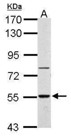Invitrogen RAD26L Polyclonal Antibody 100 &mu;L; Unconjugated:Antibodies,