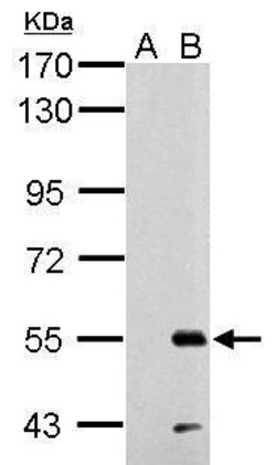 Invitrogen RAD26L Polyclonal Antibody 100 &mu;L; Unconjugated:Antibodies,