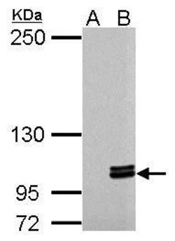 MYO1C Polyclonal Antibody, Invitrogen 100 &mu;L; Unconjugated:Antikroppar