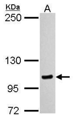 MYO1C Polyclonal Antibody, Invitrogen 100 &mu;L; Unconjugated:Antikroppar