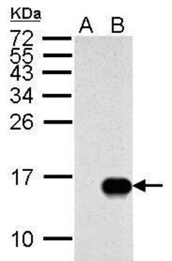 Invitrogen Influenza A M2 Polyclonal Antibody 100 &mu;L; Unconjugated:Antibodies,