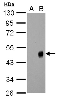 Invitrogen Influenza A H1N1 NA Polyclonal Antibody 100 &mu;L; Unconjugated:Antibodies,