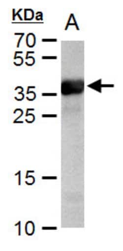 Invitrogen Cre recombinase Polyclonal Antibody 100 &mu;L; Unconjugated:Antibodies,