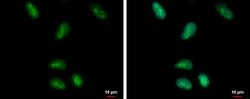 Invitrogen HMGB1 Polyclonal Antibody 100 &mu;L; Unconjugated:Antibodies,