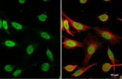 Invitrogen HMGB1 Polyclonal Antibody 100 &mu;L; Unconjugated:Antibodies,