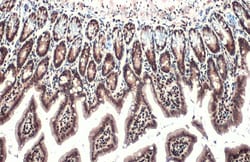 Invitrogen HMGB1 Polyclonal Antibody 100 &mu;L; Unconjugated:Antibodies,