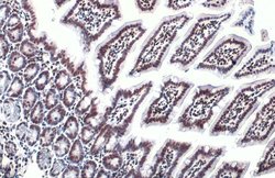 Invitrogen HMGB1 Polyclonal Antibody 100 &mu;L; Unconjugated:Antibodies,