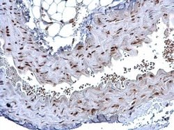 Invitrogen HMGB1 Polyclonal Antibody 100 &mu;L; Unconjugated:Antibodies,