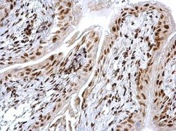 Invitrogen HMGB1 Polyclonal Antibody 100 &mu;L; Unconjugated:Antibodies,