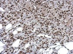 Invitrogen HMGB1 Polyclonal Antibody 100 &mu;L; Unconjugated:Antibodies,