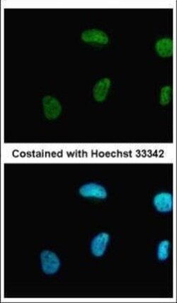 Invitrogen PRMT1 Polyclonal Antibody 100 &mu;L; Unconjugated:Antibodies,