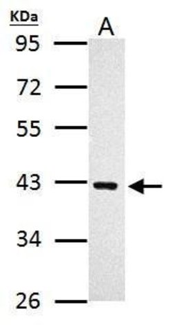Invitrogen PRMT1 Polyclonal Antibody 100 &mu;L; Unconjugated:Antibodies,