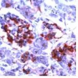 Invitrogen CD99 Polyclonal Antibody 1 mL; Unconjugated:Antibodies, Polyclonal