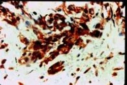 VEGF Receptor 1 Polyclonal Antibody, Invitrogen 1 mL; Unconjugated:Antikörper