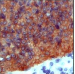 Invitrogen Cytokeratin 20 Polyclonal Antibody 500 &mu;L; Unconjugated:Antibodies,