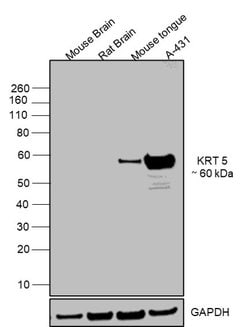 Invitrogen Cytokeratin 5 Polyclonal Antibody 1 mL; Unconjugated:Antibodies,