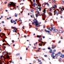 Invitrogen TSH beta Polyclonal Antibody 1 mL; Unconjugated:Antibodies,