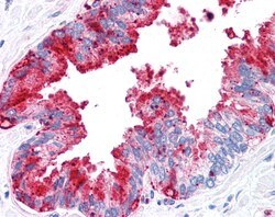 Invitrogen ADAM20 Polyclonal Antibody 50 &mu;g; Unconjugated:Antibodies,