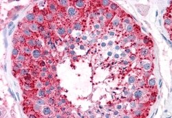 Invitrogen ADAM20 Polyclonal Antibody 50 &mu;g; Unconjugated:Antibodies,
