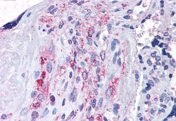 Invitrogen ADAMTS5 Polyclonal Antibody 50 &mu;g; Unconjugated:Antibodies,