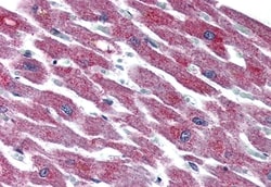 Invitrogen PACAP Receptor Polyclonal Antibody 50 &mu;g; Unconjugated:Antibodies,