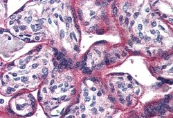 Invitrogen PACAP Receptor Polyclonal Antibody 50 &mu;g; Unconjugated:Antibodies,