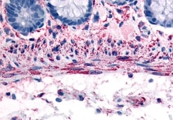 Invitrogen alpha-1b Adrenergic Receptor Polyclonal Antibody 50 &mu;g; Unconjugated:Antibodies,