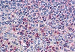 Invitrogen CD298 Polyclonal Antibody 50 &mu;g | Buy Online | Invitrogen&trade; | Fisher Scientific