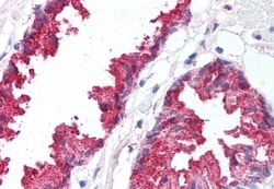 Invitrogen BACE1 Polyclonal Antibody 50 &mu;g; Unconjugated:Antibodies,