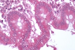 Invitrogen BACE1 Polyclonal Antibody 50 &mu;g; Unconjugated:Antibodies,